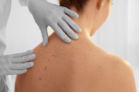 DERMATOLOGIA