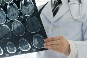 NEUROLOGIA