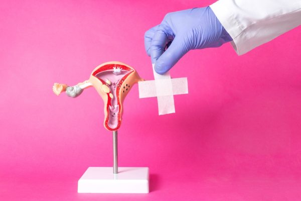 Diagnosi e trattamento del prolasso uterino