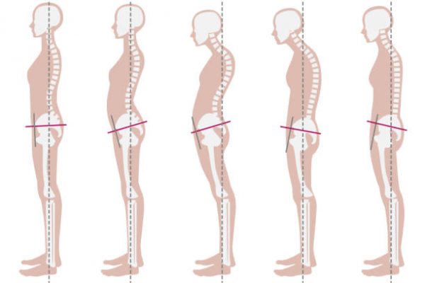 Postura corretta: prevenire è meglio che curare!