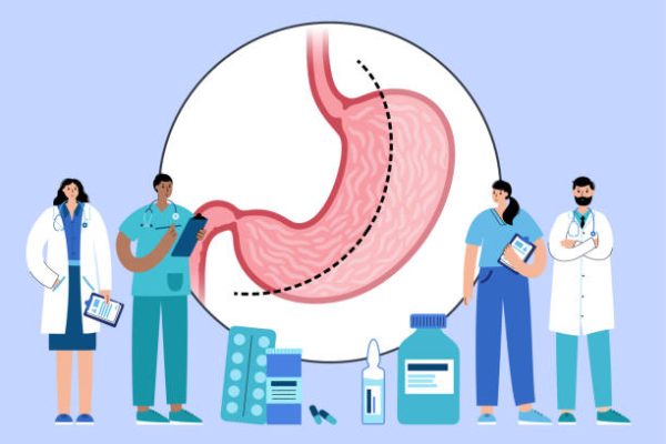 Chirurgia bariatrica: un percorso sicuro ed efficace per ritrovare salute e benessere