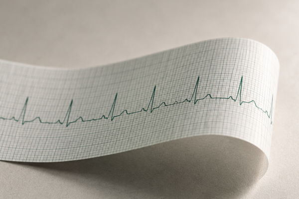 La prima visita cardiologica con ECG